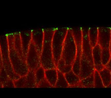 epithelial cell under superresolution microscope